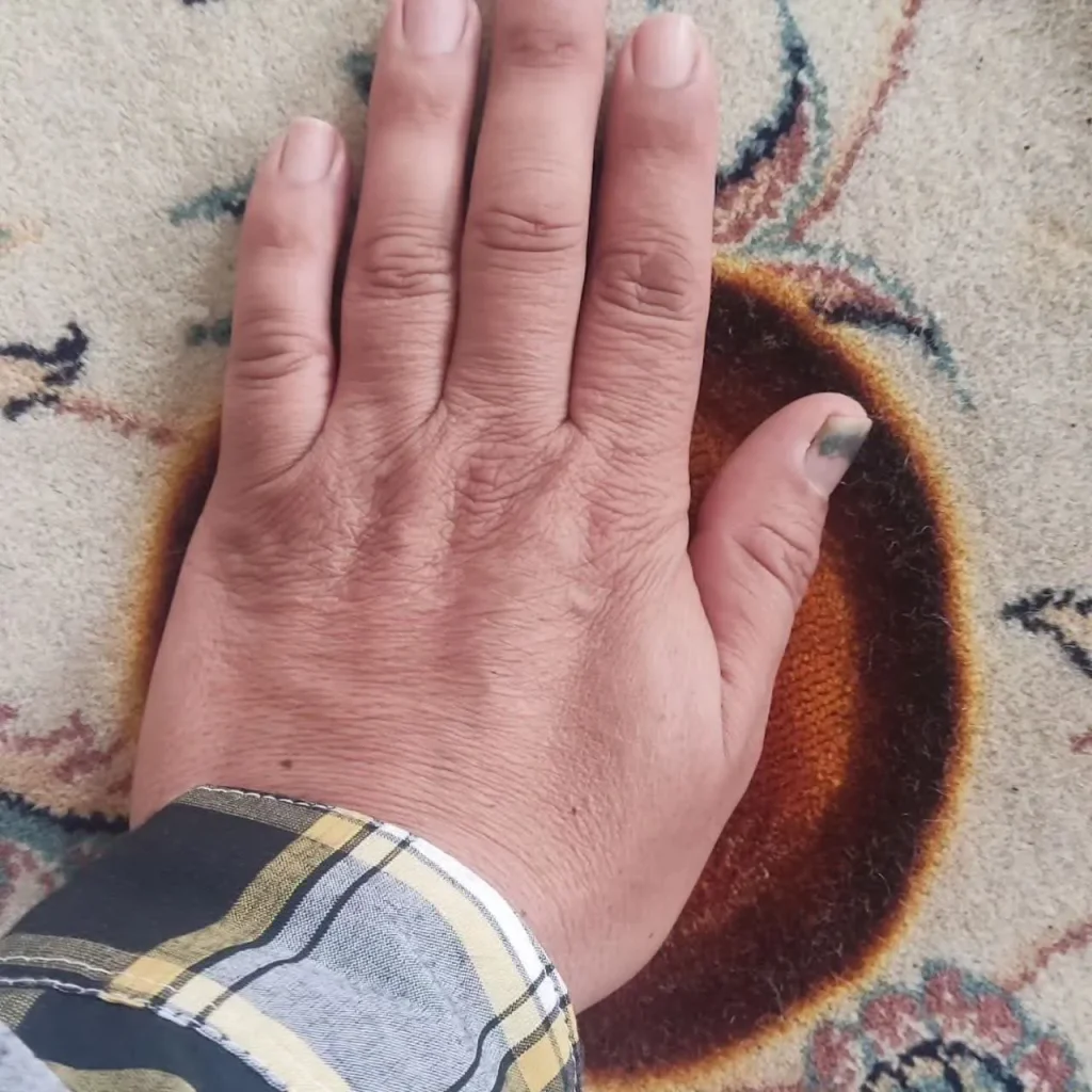 سوختگی فرش ماشینی